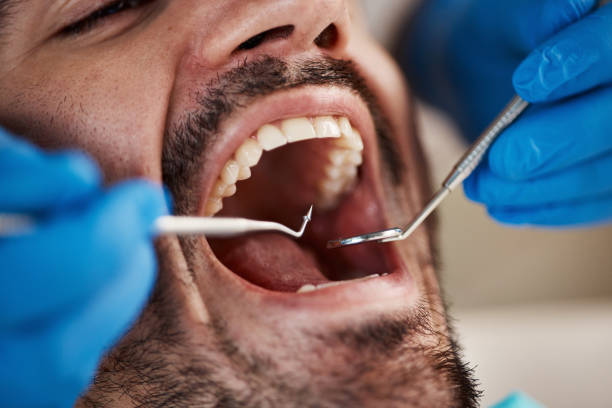 Professional Emergency Dental Service in MI